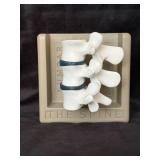 Anatomical Lumbar Spine Model with Diagram