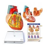 New EVOTECH SCIENTIFIC Human Heart Model For