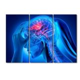 Canvas Wall Art X Ray Fitness Center Modern Artwor
