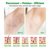At-Home IPL Hair Removal for Women and Men Permanent Hair Removal 500,000 Flashes Painless Hair Remover on Armpits Back Legs Arms Face Bikini Line does not have razor