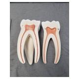 3B Scientific D15 Giant Molar w/ Dental Caries 15x life-size 6-part - 3B Smart Anatomy