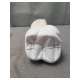 3B Scientific D15 Giant Molar w/ Dental Caries 15x life-size 6-part - 3B Smart Anatomy