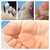 Exfoliating Mask for Gentle Feet (2 pairs, 1 to 2 weeks), to remove calluses and dead skin, for men and women