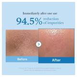Medicube Zero Pore Blackhead Cleansing Oil | Makeup Remover for all skin types, Daily Moisture Facial Cleanser, Low-Irritation | Korean Skin Care (205ml / 6.93 fl.oz)