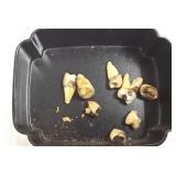 Group of assorted gold teeth, etc.