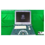 GE Voluson Ultrasound System