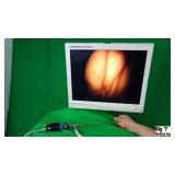 Circon ACMI 0 Degree Laparoscope Circon ACMI 0 Degree Laparoscope