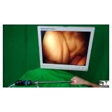 Circon ACMI Lap 10-30w 30 Degree Laparoscope Circon ACMI Lap 10-30w 30 Degree Laparoscope