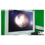 Smith&Nephew 72202961 30 Degree HD Arthroscope