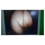 Olympus A2013A 70 Degree Autoclavable Cystoscope