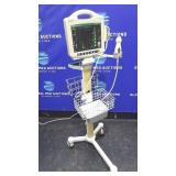 Bard Site Rite 5 Ultrasound System