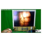 Olympus A2033A Autoclavable 70 Degrees Laparoscope Olympus A2033A Autoclavable 70 Degrees Laparoscope