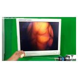 Olympus A1932A 30 Degrees Laparoscope Olympus A1932A 30 Degrees Laparoscope
