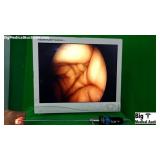 Linvatec 7574 0 Degree Laparoscope Linvatec 7574 0 Degree Laparoscope