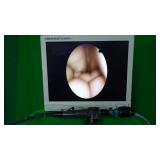 Olympus OSF-2 Flexible Sigmoidoscope w/ Case Olympus OSF-2 Flexible Sigmoidoscope w/ Case