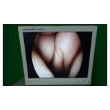 Olympus WA50373B 30 Degree Laparoscope Olympus WA50373B 30 Degree Laparoscope