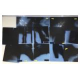 14 - 10x12 Medical X-Rays