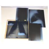 4 Spine & Chest X-Rays