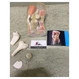 Doctors office display in the knee