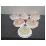 (6) Ceiling Light Fixtures (13 1/2" diameter)