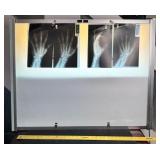 VINTAGE LIGHT UP X-RAY BOARD