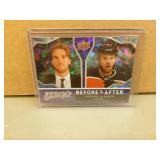 2021-22 UD Connor McDavid BA2 Before & After Card