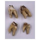 Collection of teeth
