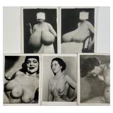 ODDITY - BREAST DEFORMITY PHOTOGRAPHS