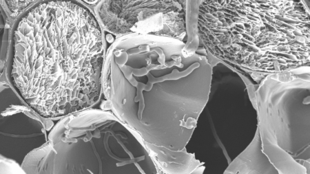 Scanning electron image of Fusarium squeezing through channels from one cell to another.