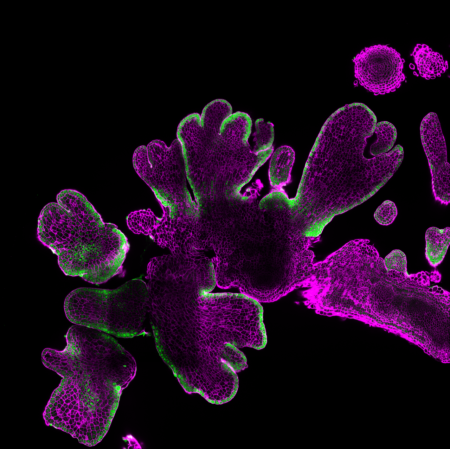 A cross-section through an Arabidopsis root that regenerates somatic embryos after induction of PLT/WOX (the green signal along the outer edge is GFP expression of an embryonic gene. Image courtesy of Wageningen University & Research.