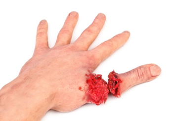 First-aid-open-wounds.png#asset:188458