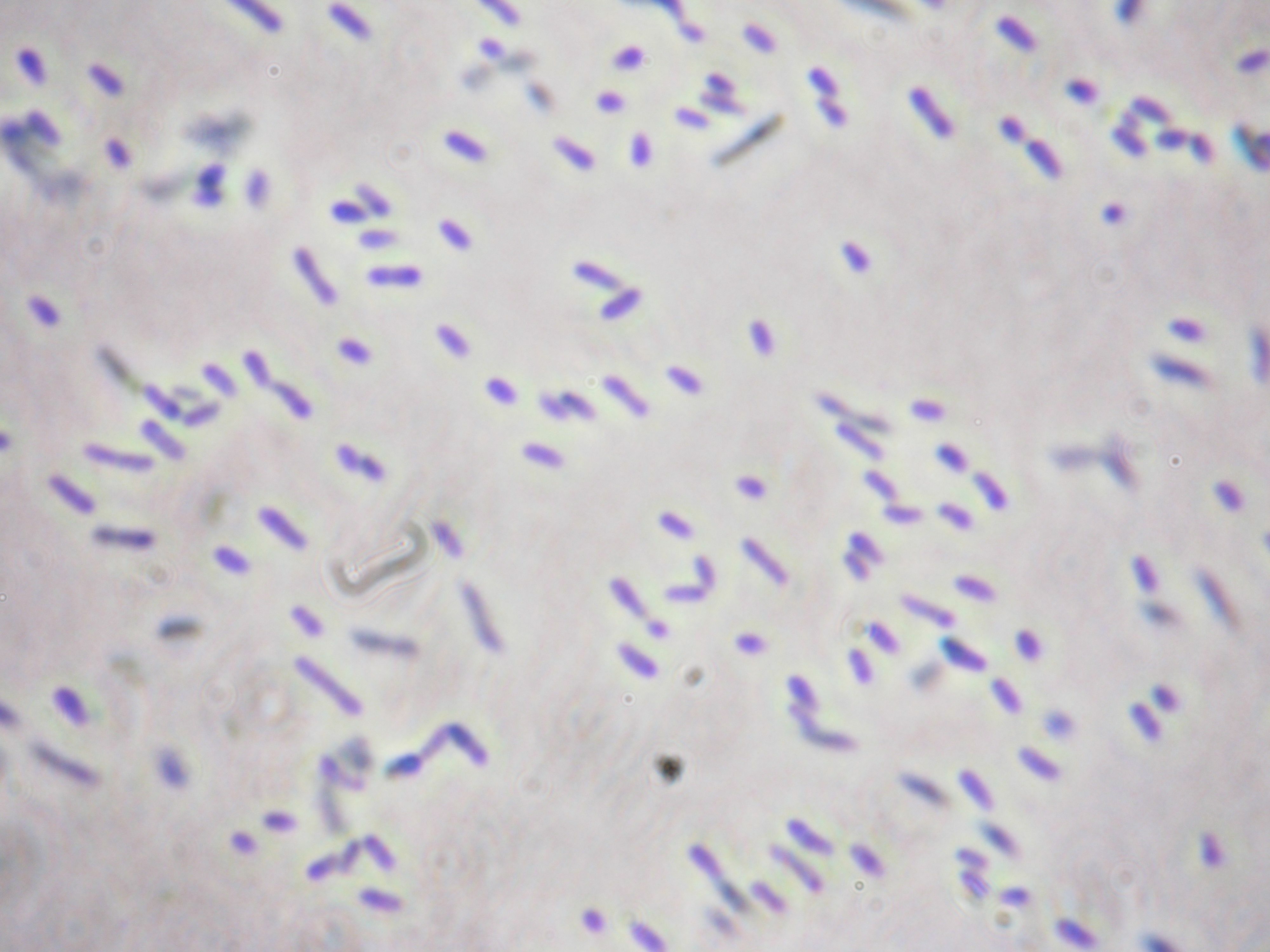 Lima Bean Growth: The Hidden Impact Of Worms - vkgkgbf