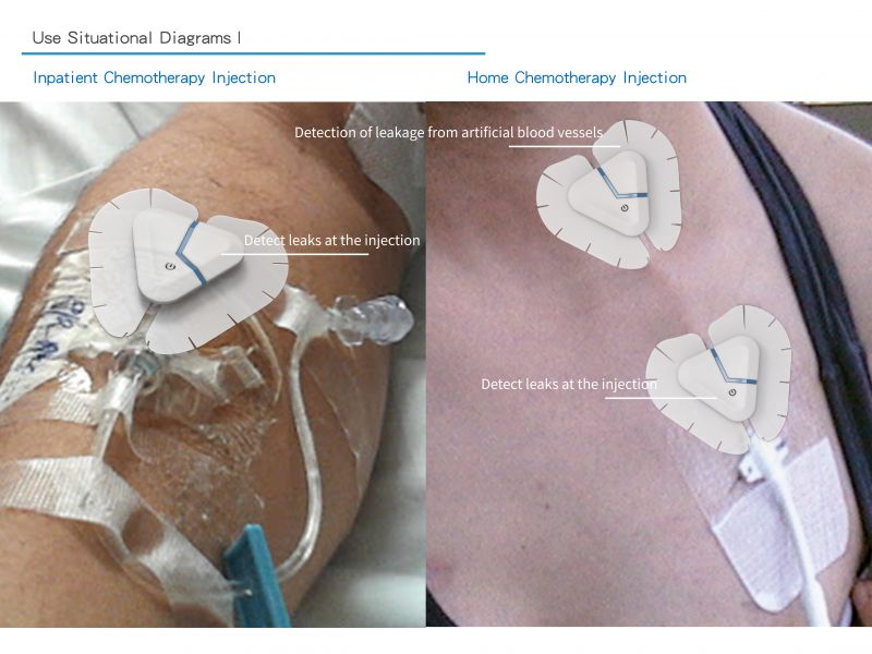 Beep Beep! Intravenous infusion leak detector