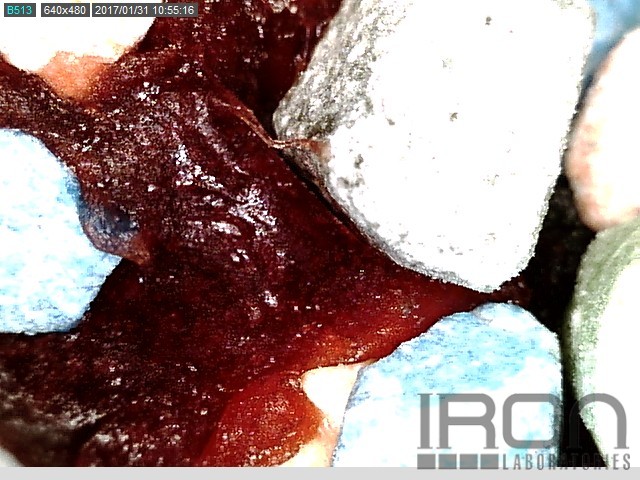 Sample #90157