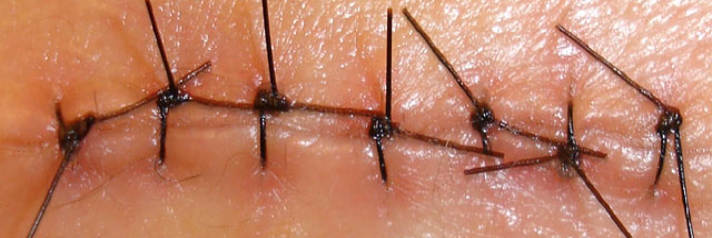 Cover image for post THE HEALER, by AMcKeown