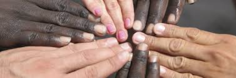 Cover image for post Racism, by itsdemoray