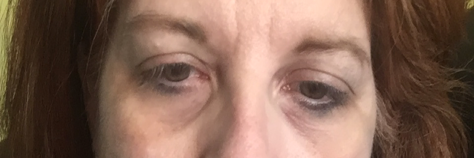 Cover image for post Unlovable, by Vyxyn