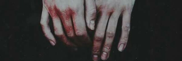 Cover image for post Pain, by RossanaDelila