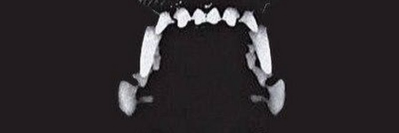 Cover image for post I'm vicious when I'm dead, by LaurusTet