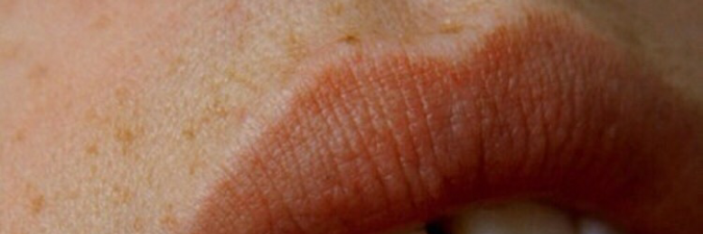 Cover image for post peachy lips, by awriteratheart