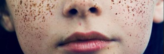 Cover image for post Uneven Melanin, by rhale3