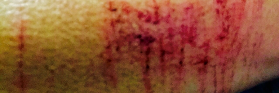 Cover image for post Maybe the Plane Will Crash, by YAngeL