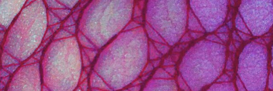 Cover image for post Abnormal, by DesireeSavini