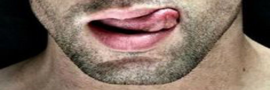 Cover image for post Tongue-a-licious, by FrankieBoy