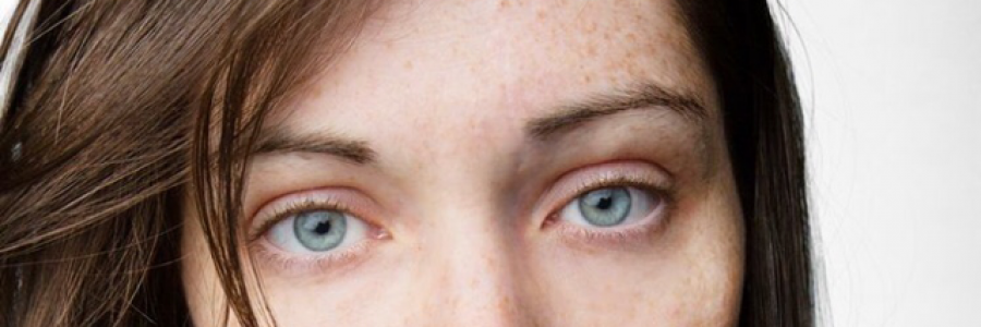 Cover image for post The Girl Covered in Scars, by Blossom17