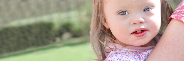 Cover image for post The Disabled, The Lucky, by RaneMcC