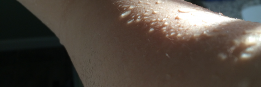 Cover image for post Untitled, by Lizzosaurus