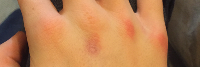 Cover image for post Crazy For Girls, by RaneMcC