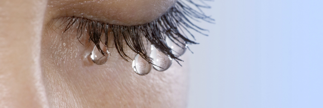 Cover image for post "Scars", by Soniaowilliams