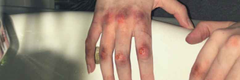 Cover image for post Twenty-four, by Milica